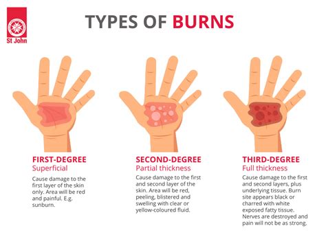 Do burns turn yellow when healing?