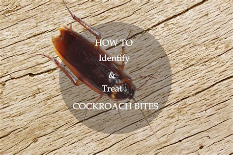 Do cockroaches bite?