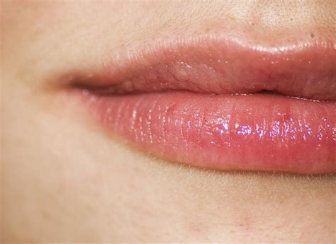 Do cold sores leave scars?