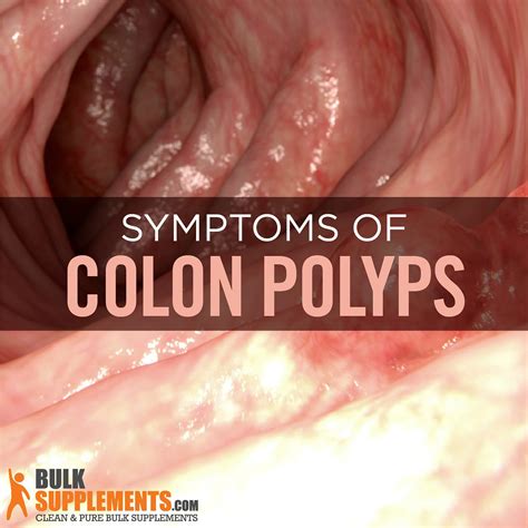 Do colon polyps stick out?