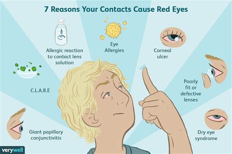 Do contacts hurt your eyes at first?