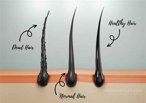 Do dead ends affect hair growth?