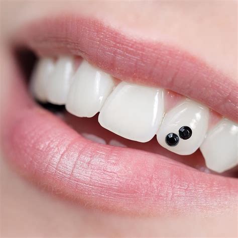 Do dentists hate tooth gems?