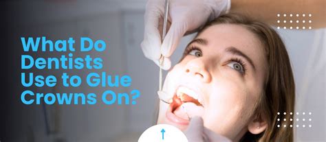 Do dentists use glue?