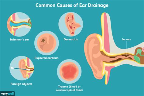 Do ears drain during ear infection?