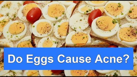 Do eggs cause acne?