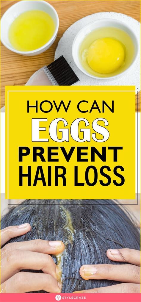 Do eggs cause hair loss?
