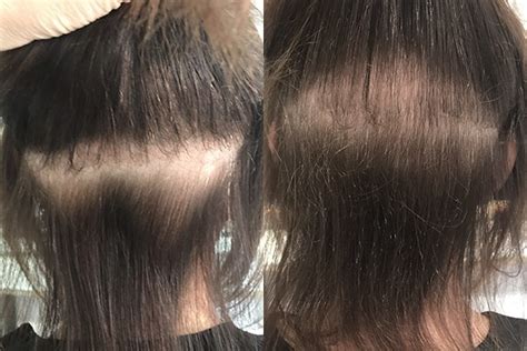Do extensions damage hair growth?