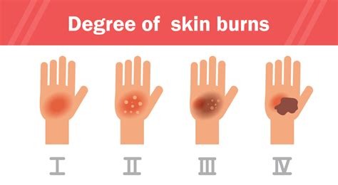 Do first degree burns turn brown?
