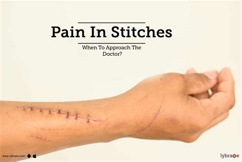 Do glue stitches hurt?