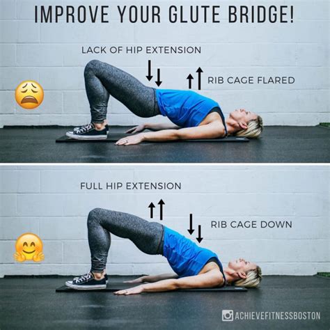 Do glute bridges fix posture?
