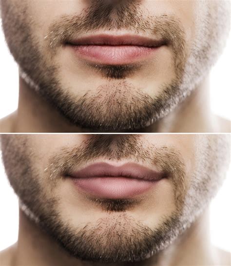 Do guys like thin or thick lips?