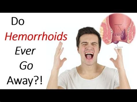 Do hemorrhoids ever fully go away?