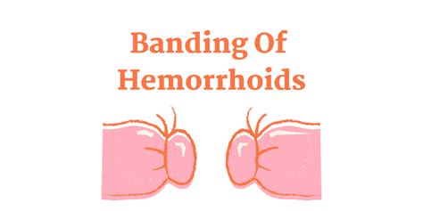 Do hemorrhoids itch after banding?