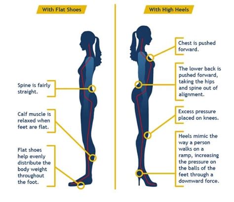 Do high heels improve posture?