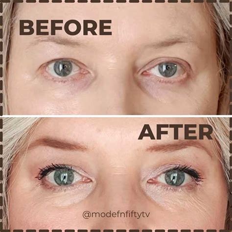 Do hooded eyes age faster?