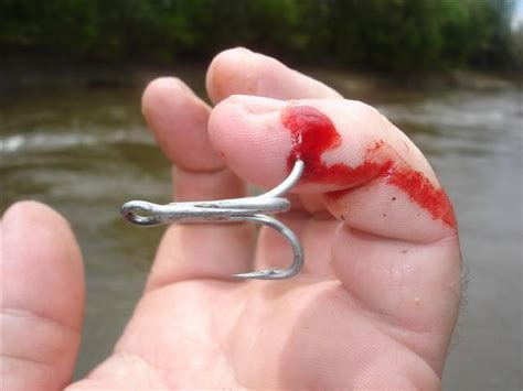 Do hooks hurt fish?