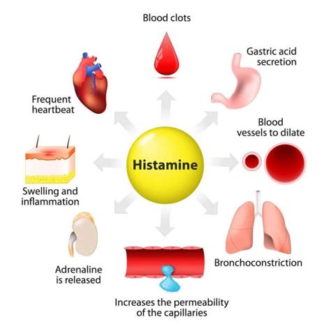 Do hot showers release histamine?