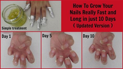 Do human nails grow back?