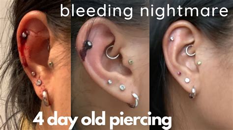 Do irritated piercings bleed?