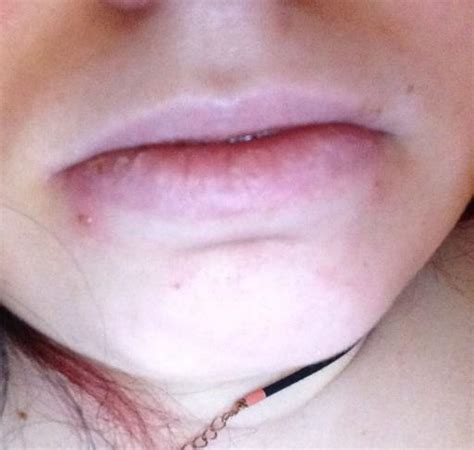 Do lip piercing holes ever go away?