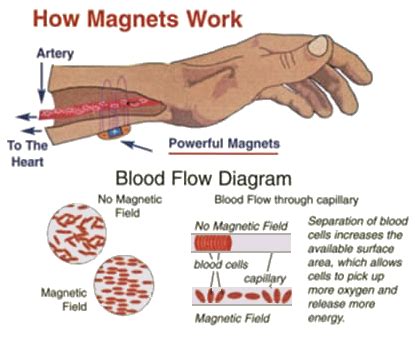 Do magnets cause health problems?