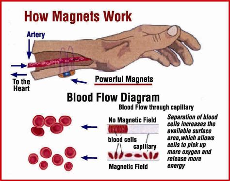 Do magnets remove toxins from the body?