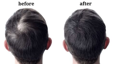 Do men notice healthy hair?