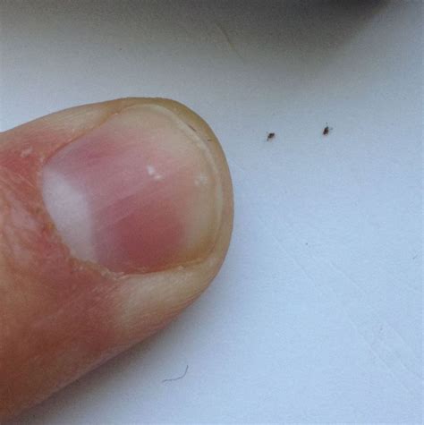 Do mites crawl in your skin?