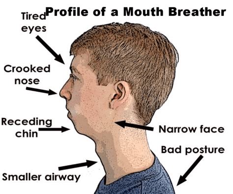 Do mouth breathers chew with their mouth open?