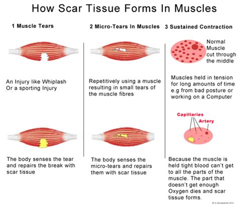 Do muscles grow after massage?
