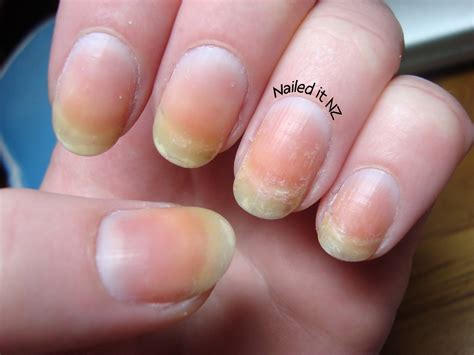 Do nail polish stains fade?