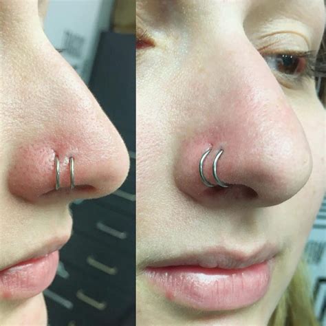 Do nose piercing holes heal?