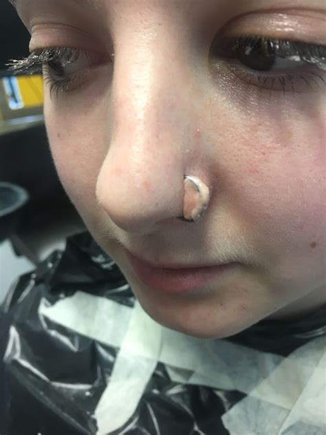 Do nose piercing scars go away?