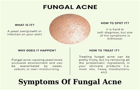 Do oils cause fungal acne?