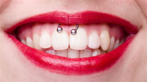 Do oral piercings damage teeth?