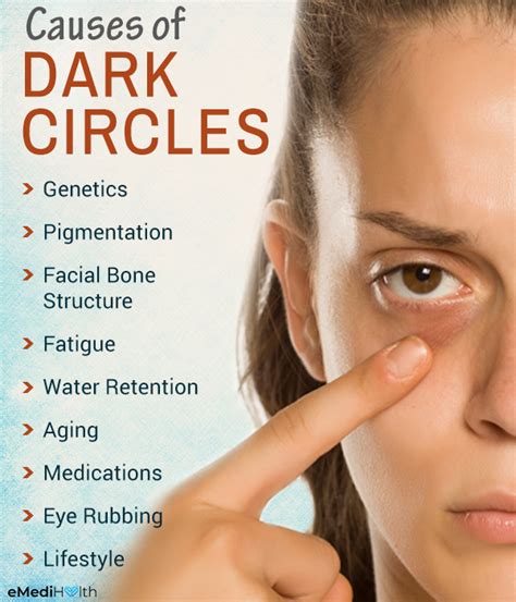 Do parasites cause dark circles under eyes?