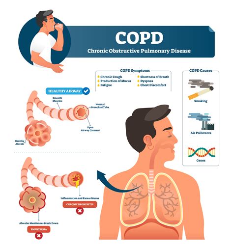 Do people live 20 years with COPD?