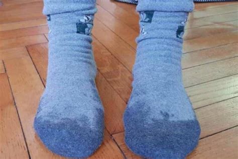Do people sleep with wet socks?
