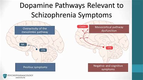 Do people with schizophrenia have more dopamine receptors?
