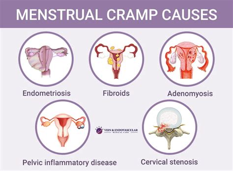 Do period cramps feel like labor?