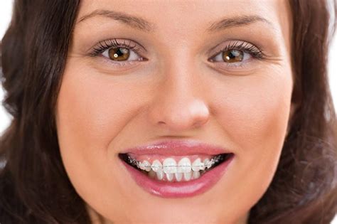 Do plastic braces hurt?