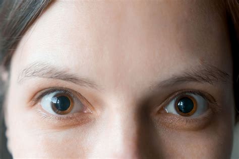 Do pupils get bigger or smaller with fear?