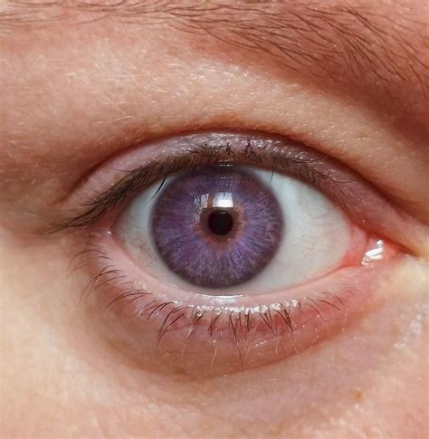 Do purple eyes exist?