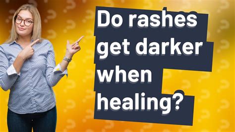 Do rashes get darker when healing?