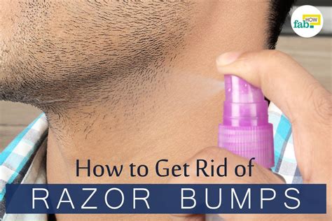 Do razor bumps go away?