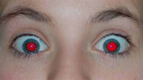 Do red eyes exist?