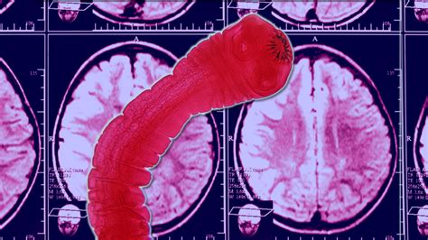 Do red worms have a brain?