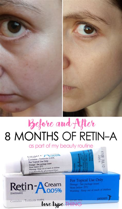 Do retinoids age your skin?