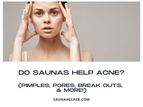 Do saunas help with acne?